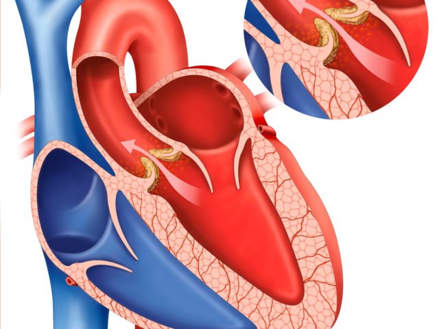 What is “Syncope” & “Orthostatic Hypotension”?  Syncope And Orthostatic Hypotension Treatment – Drkharkar