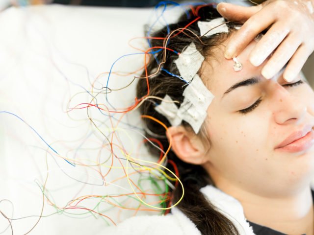 What are the EEG findings in Epilepsy?