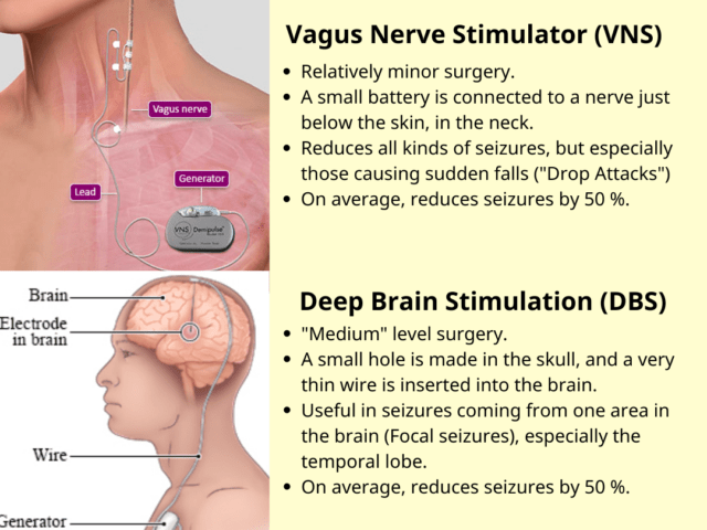 Neuromodulation / Neurostimulation for Epilepsy