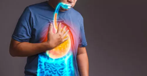 What is “Sandifer Syndrome”?