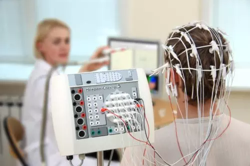 Evaluation of Psychogenic Non-Epileptic Seizures (PNES)