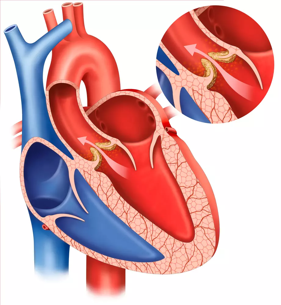 What is “Syncope” & “Orthostatic Hypotension”? Syncope And Orthostatic Hypotension Treatment – Drkharkar