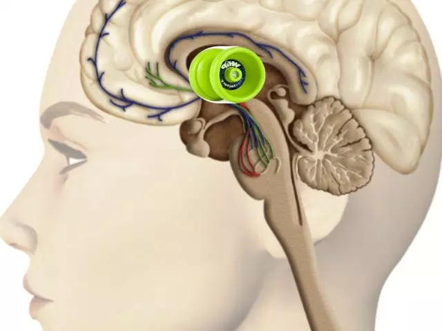 deep brain stimulation