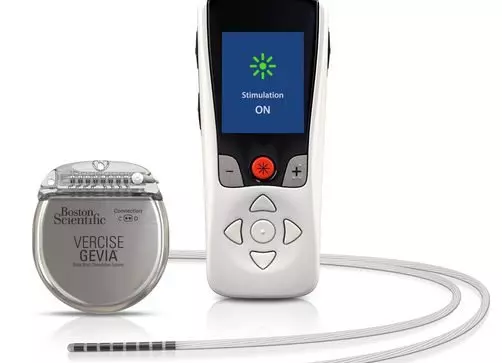 stimulation device