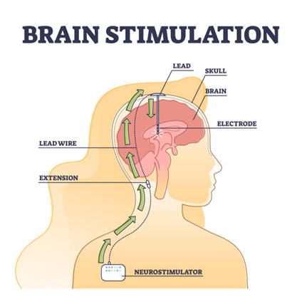 Brain Stimulation Illustration