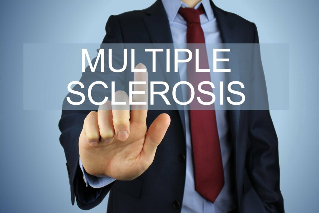 Early Signs of Multiple Sclerosis 2 Early Signs of Multiple Sclerosis