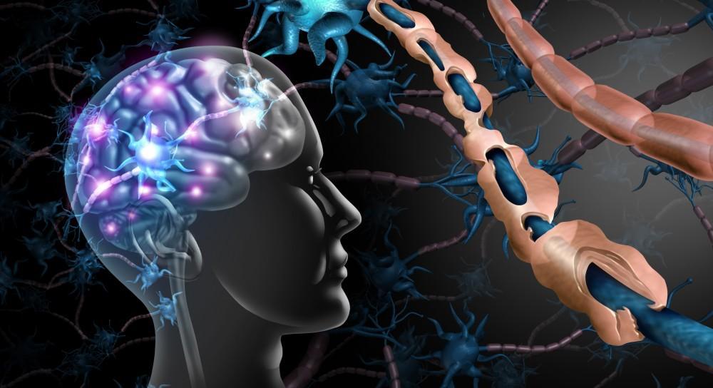 Multiple Sclerosis Treatment in Thane