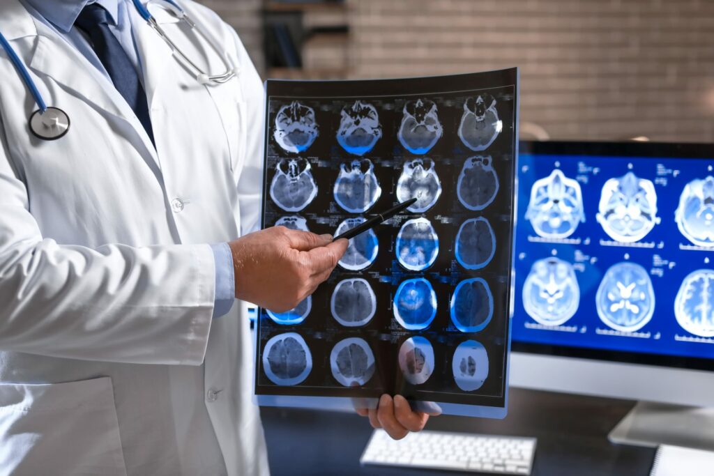 What Is the Difference Between EEG, EMG and NCV? 2 EEG, EMG and NCV