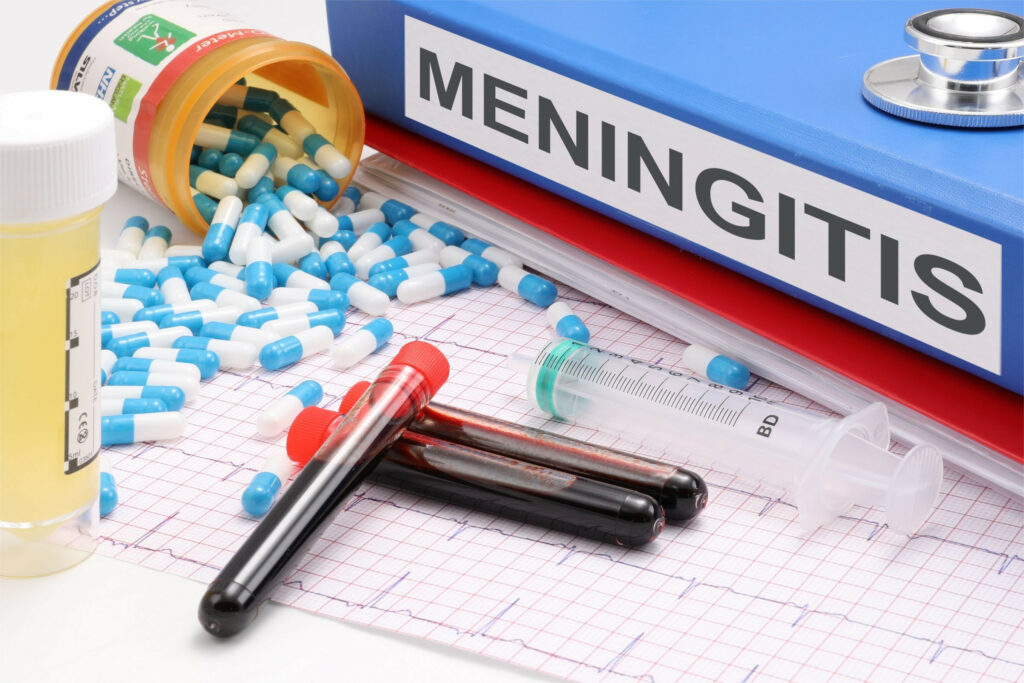 Meningitis Warning Signs in Adults: Early Symptoms You Should Not Ignore 2 Meningitis Warning Signs in Adults