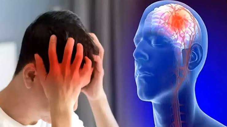 How to Reduce the Risk of a Second Stroke 3 Reduce the Risk of a Second Stroke