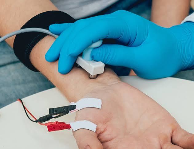 When Is NCV/EMG Needed for Nerve Problems? 3 NCV test